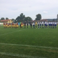 U15 + U14 ČLŽ: FK Náchod - FK Dukla Praha